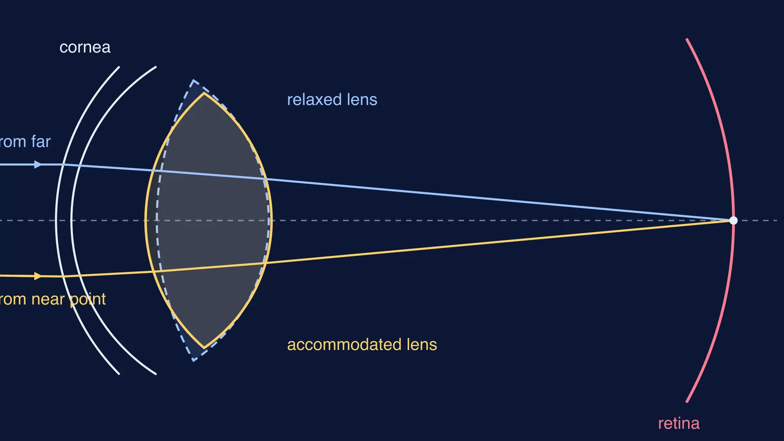 Eye lens outlines, relaxed and thicker accommodated, both focusing light on the retina