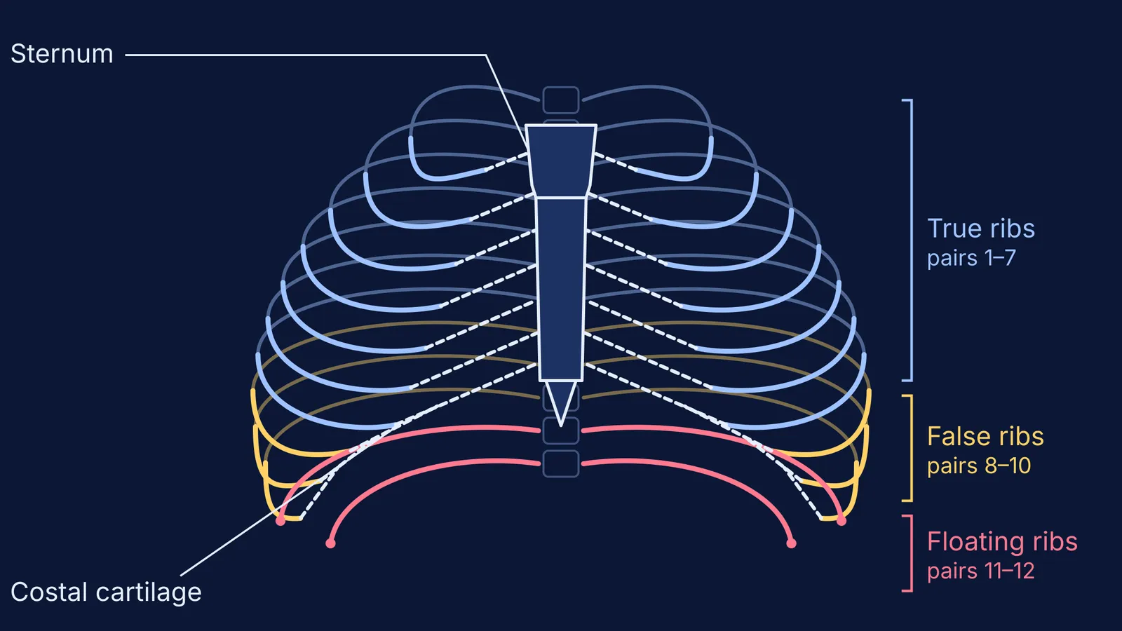 Front view of the rib cage with true, false and floating ribs colour-coded
