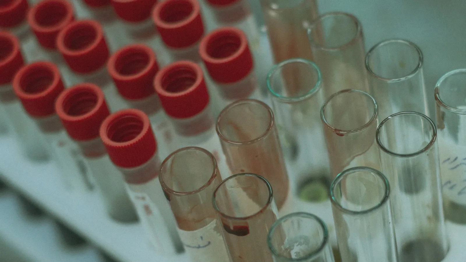 Glass test tubes with red caps in a rack