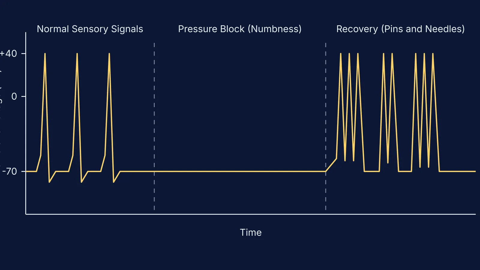 Graph showing action potentials blocked by pressure and ectopic firing upon recovery.