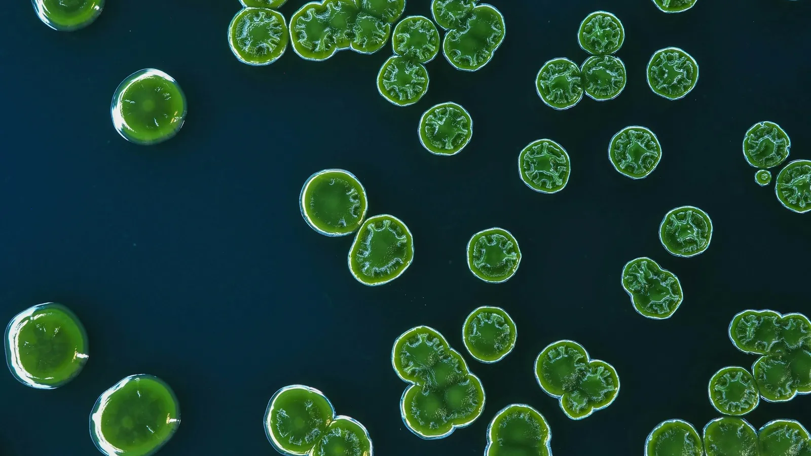 Green single-celled organisms under a microscope