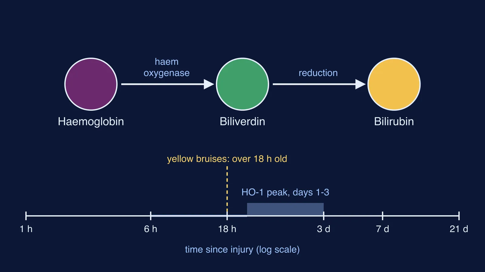 Haemoglobin to biliverdin to bilirubin pathway above a bruise-healing timeline