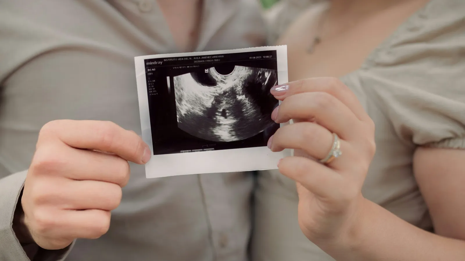 Hands holding an ultrasound scan print