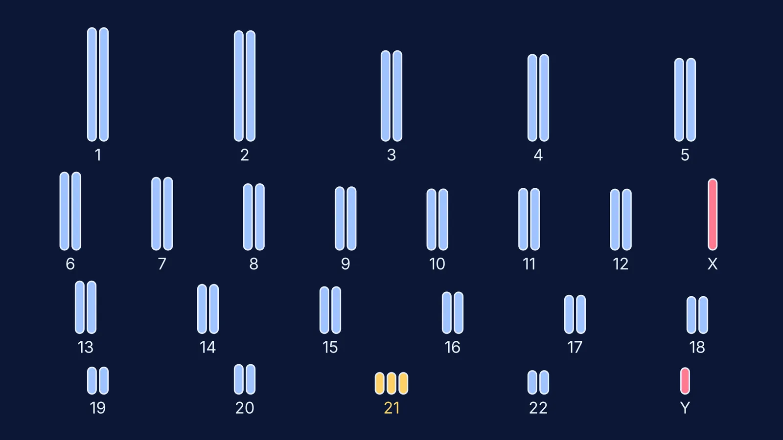 Karyotype diagram of 47 chromosomes with three copies of chromosome 21 and XY