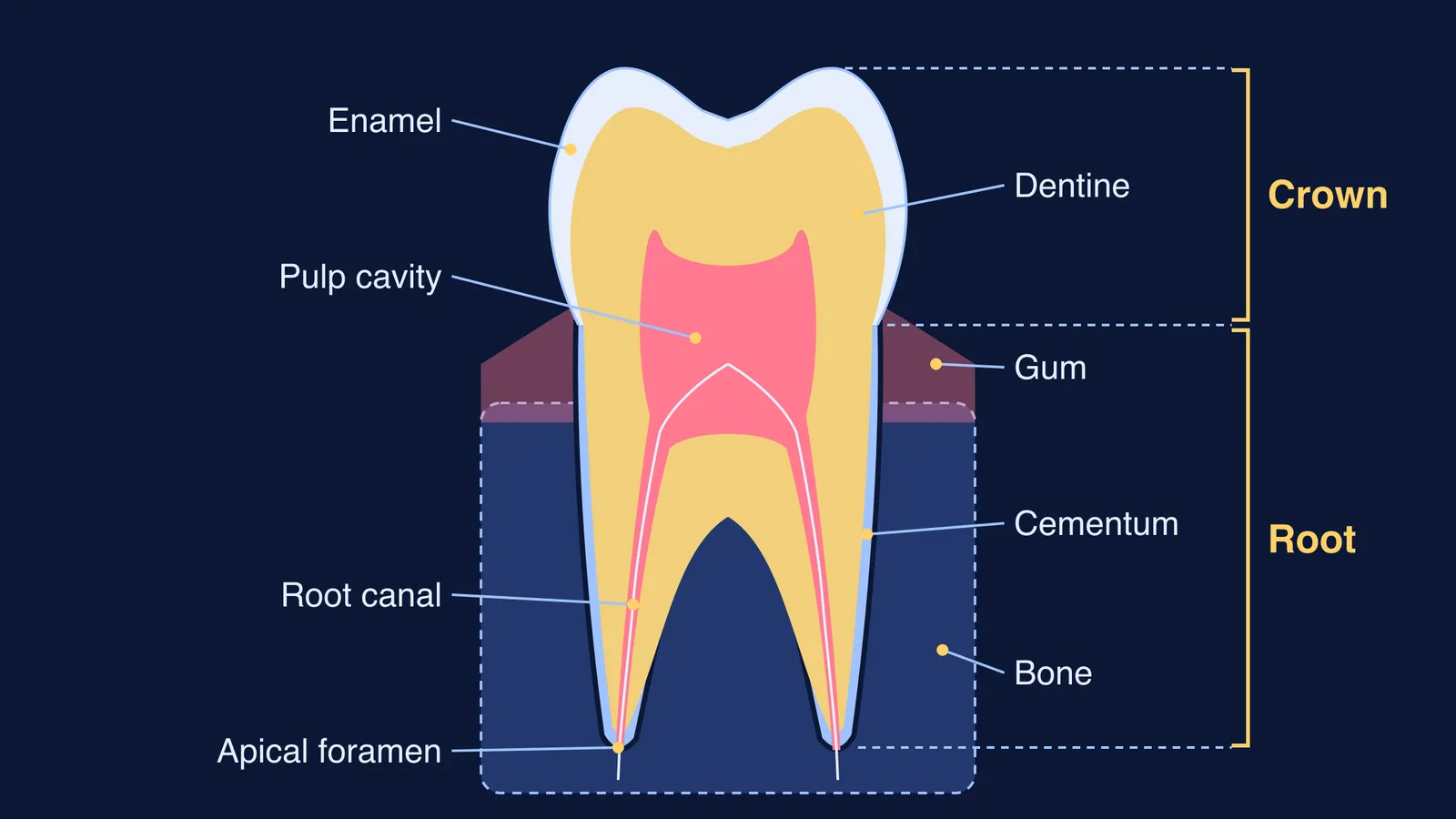 Labelled section of a two-rooted molar showing enamel, dentine, pulp, cementum, gum and bone