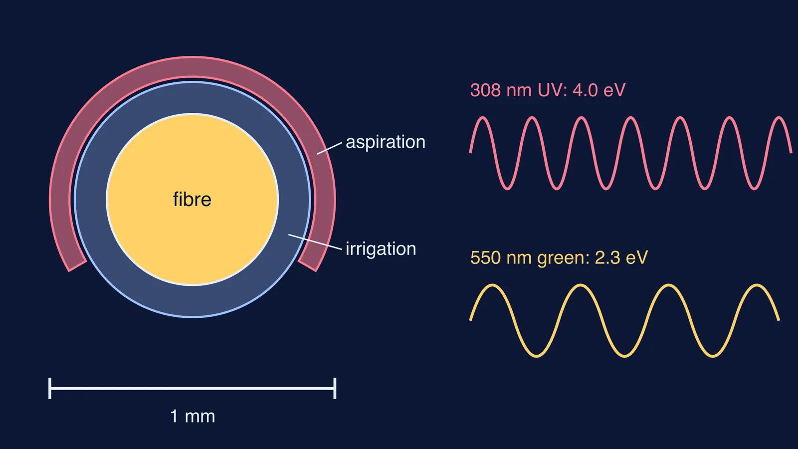 Laserphaco probe tip cross-section beside ultraviolet and green light waves