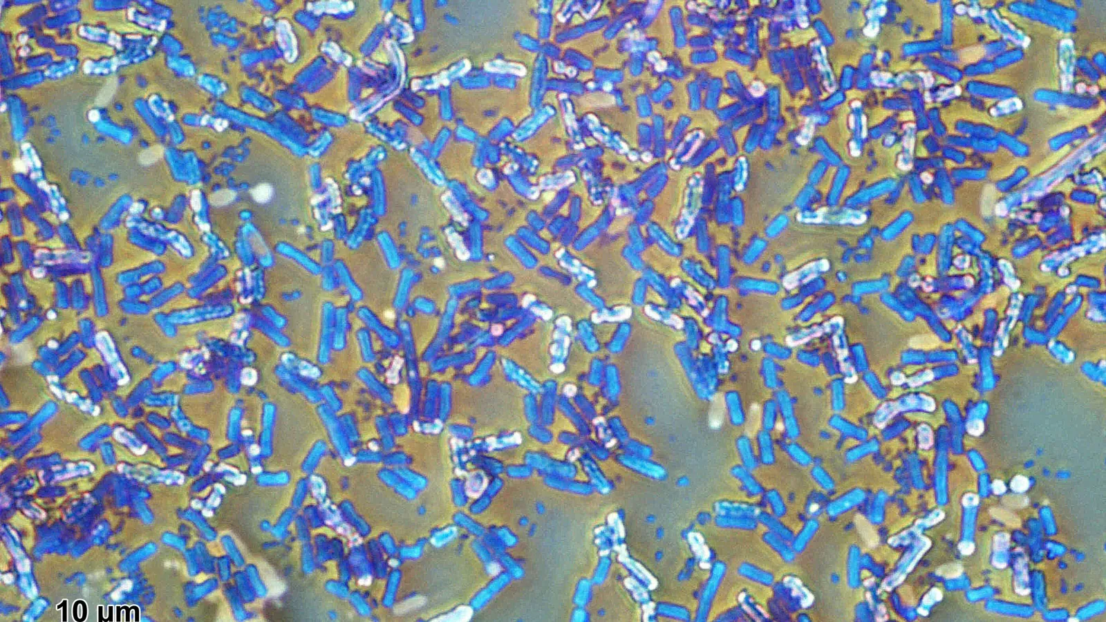 Micrograph of blue-stained Bacillus subtilis rods, many holding pale oval endospores