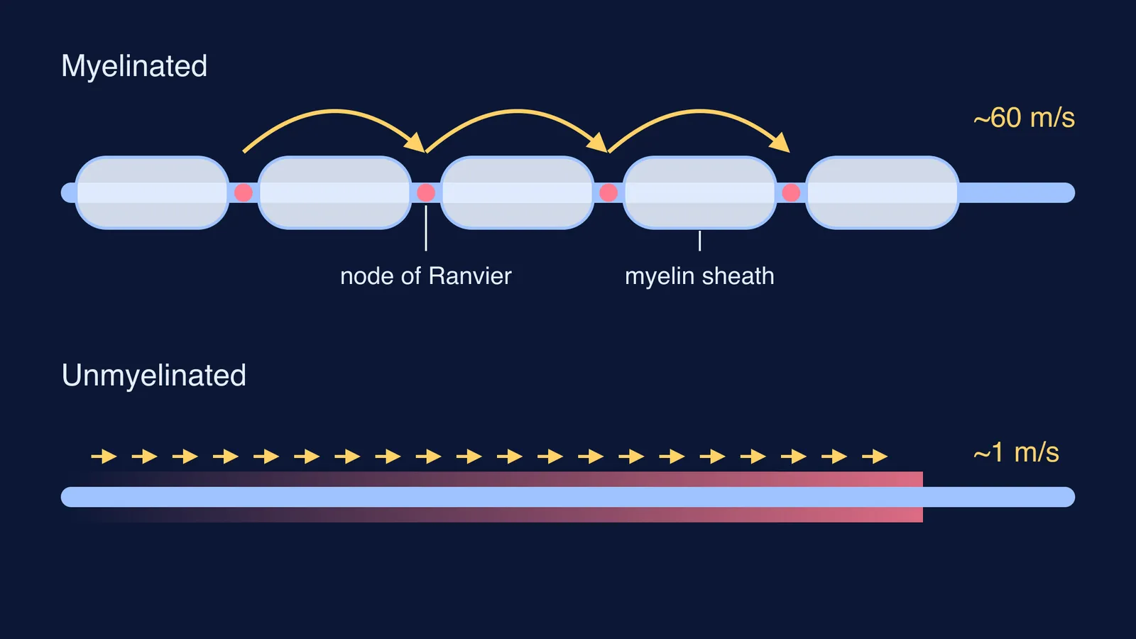 Myelinated axon with impulse jumping between nodes above a continuously conducting unmyelinated axon