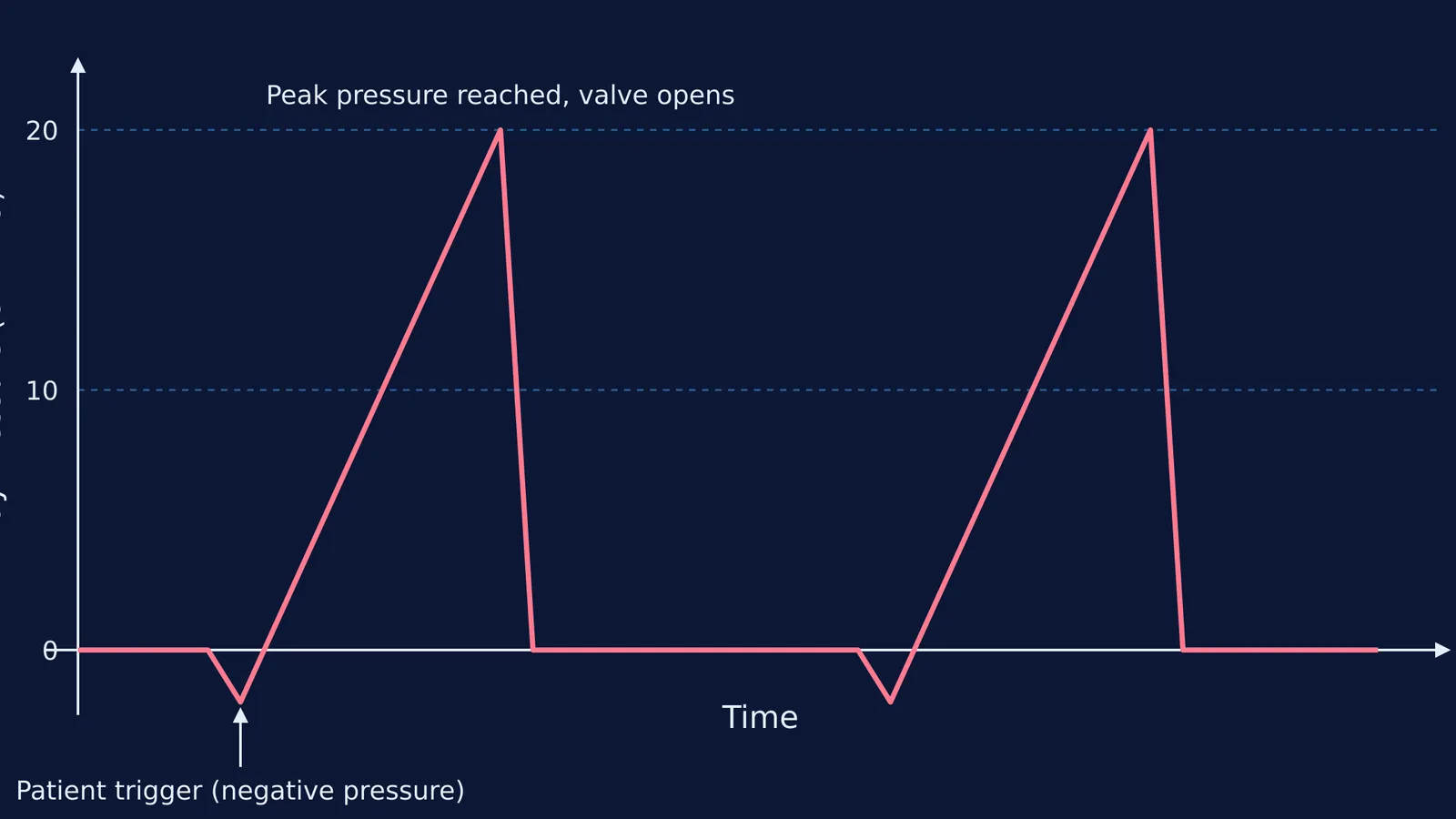 Pressure vs time graph of a pressure-triggered, positive-pressure ventilator breath
