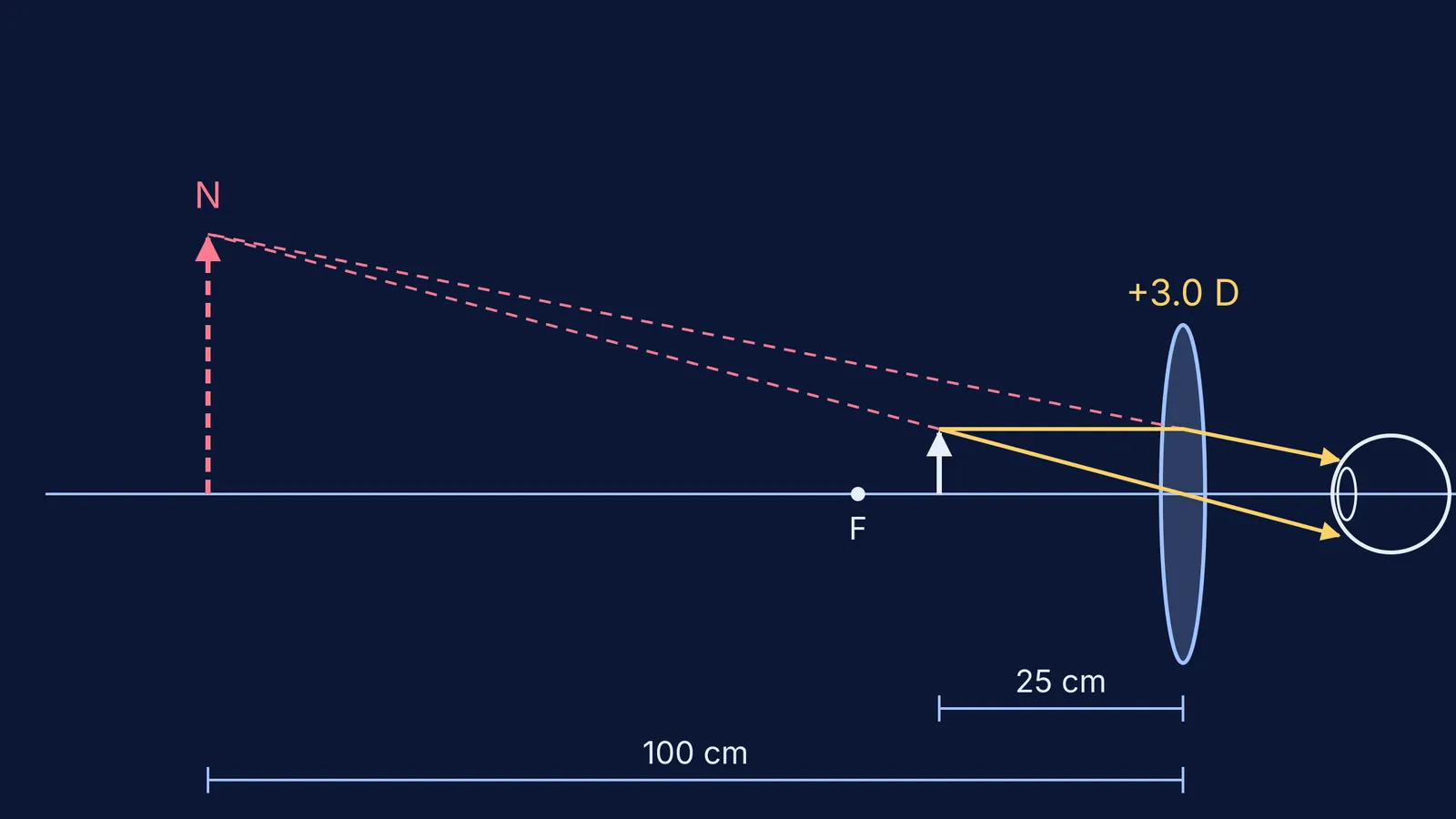 Ray diagram: convex lens images an object at 25 cm onto a 1 m near point