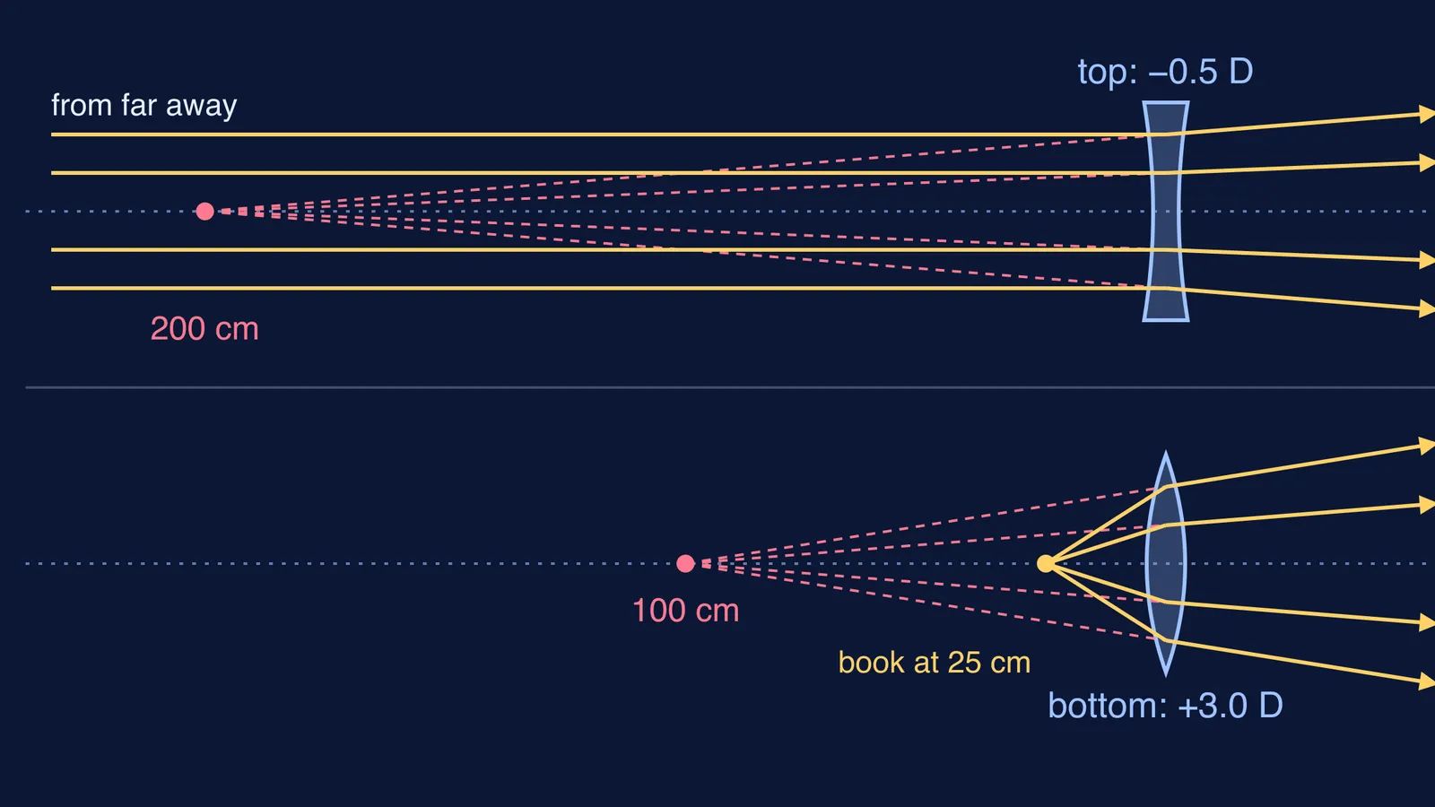 Ray diagram of a bifocal lens: concave top for distance, convex bottom for reading