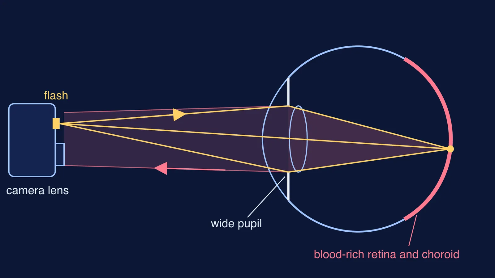 Ray diagram of flash light entering a wide pupil and reflecting back to the camera