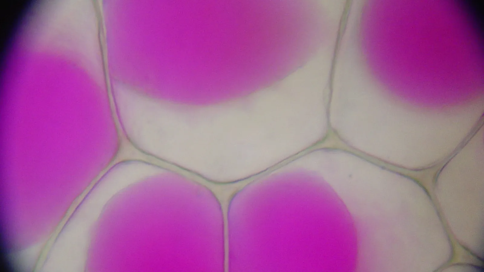 Rhoeo leaf epidermis cells under a microscope, pink vacuoles shrunk from cell walls
