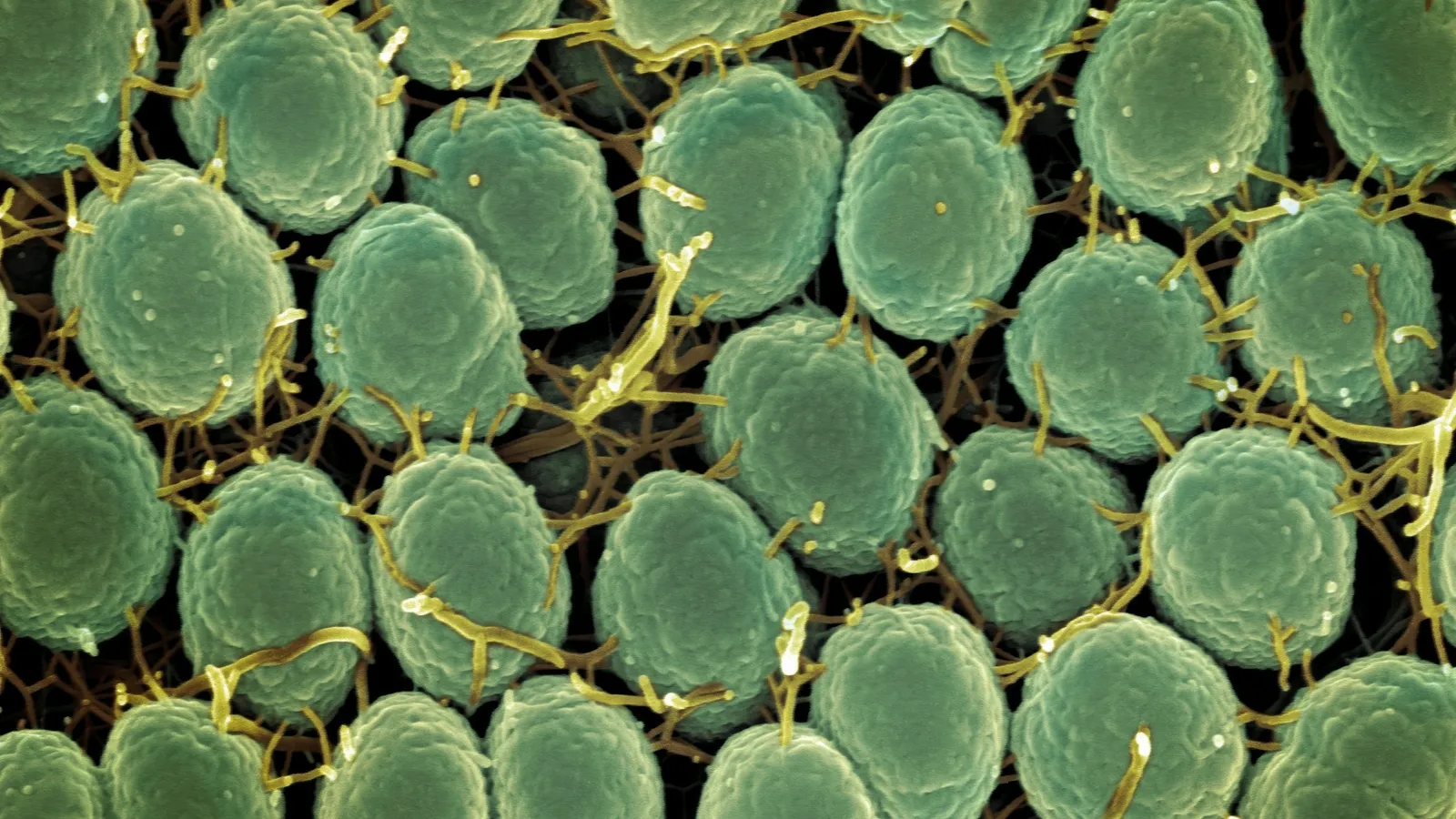 Rounded green plant cells packed together under a microscope