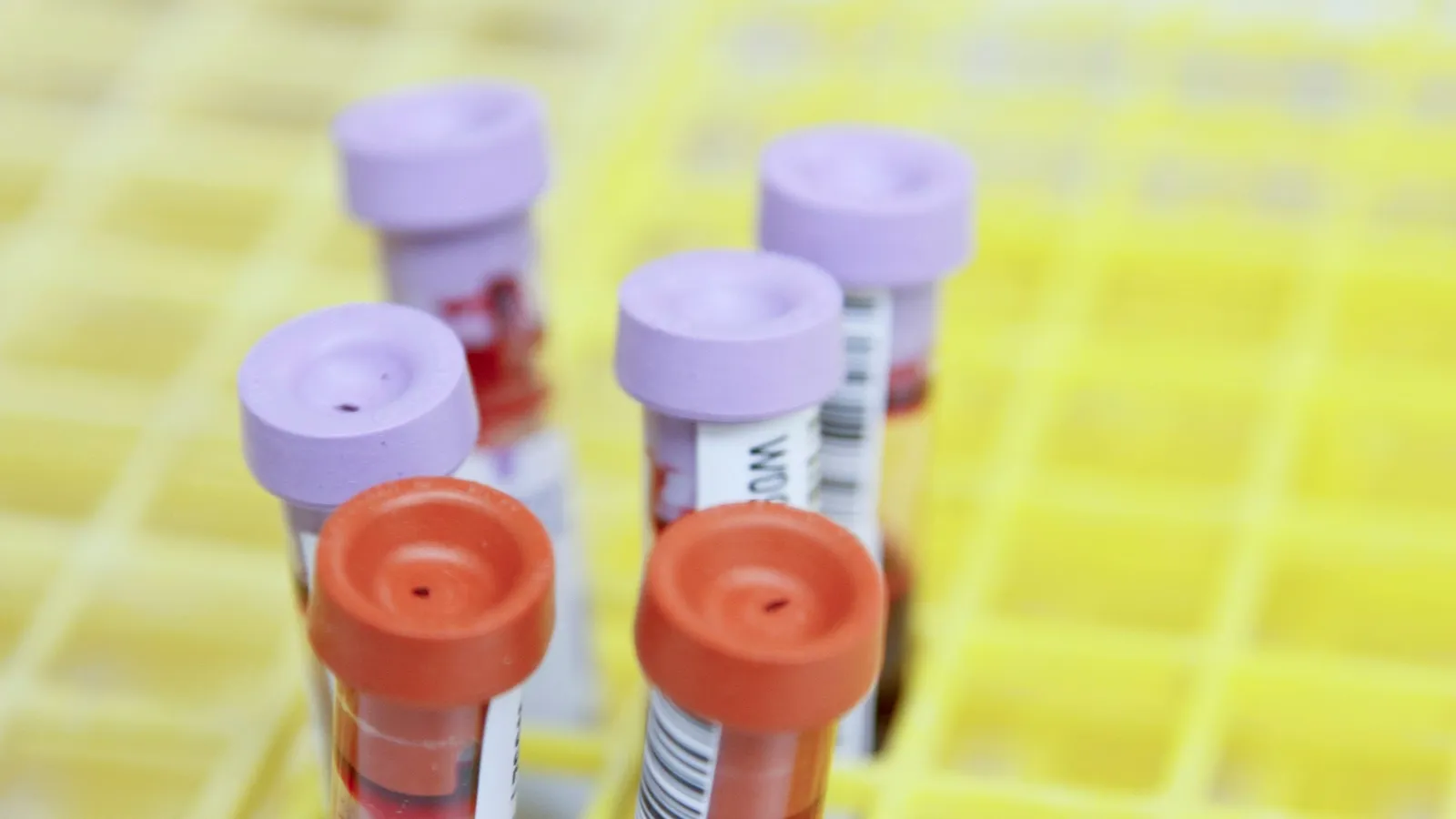 Sample tubes with coloured caps in a yellow rack