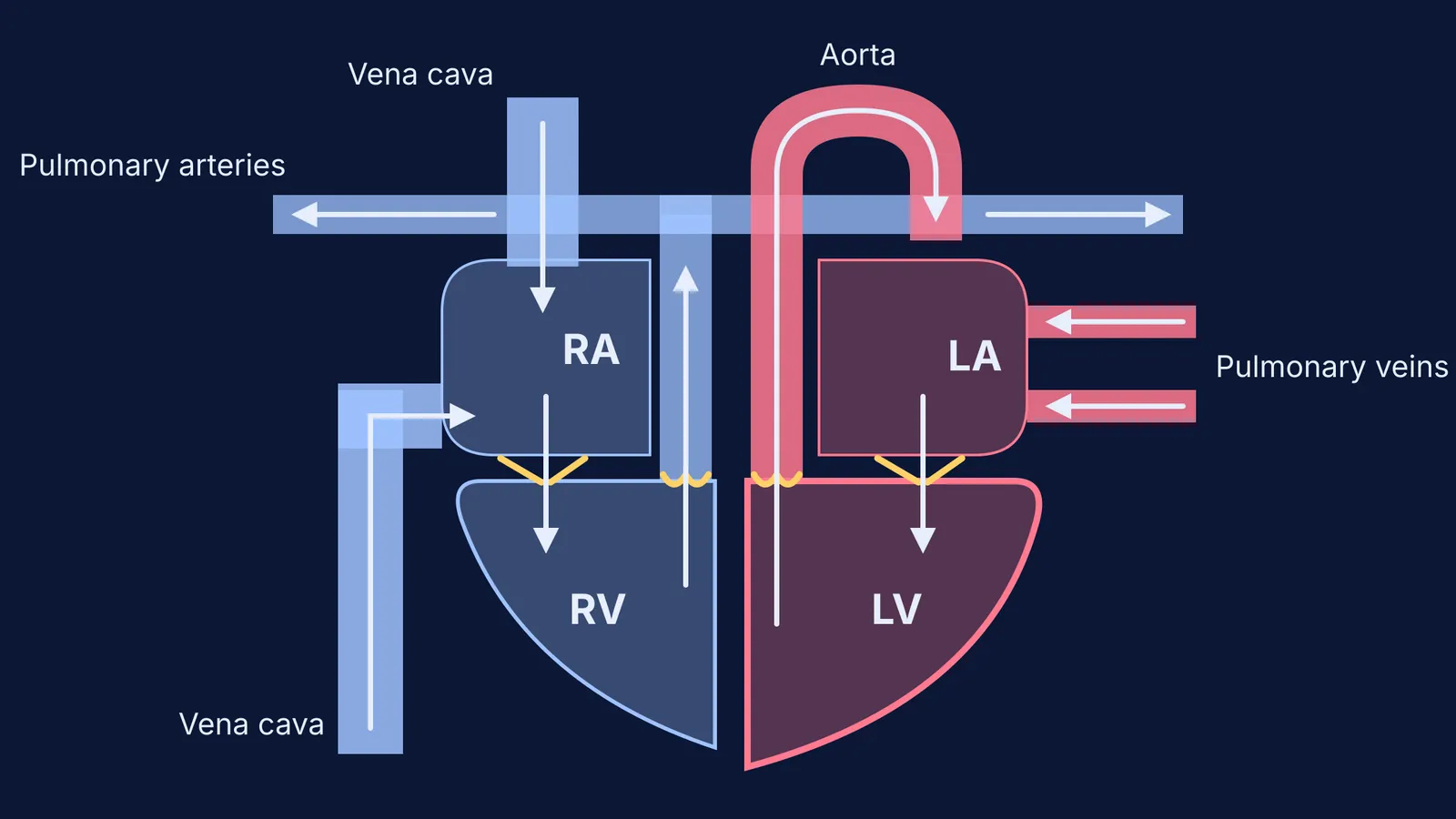 Schematic heart with blue right chambers, red left chambers, vessels and valves