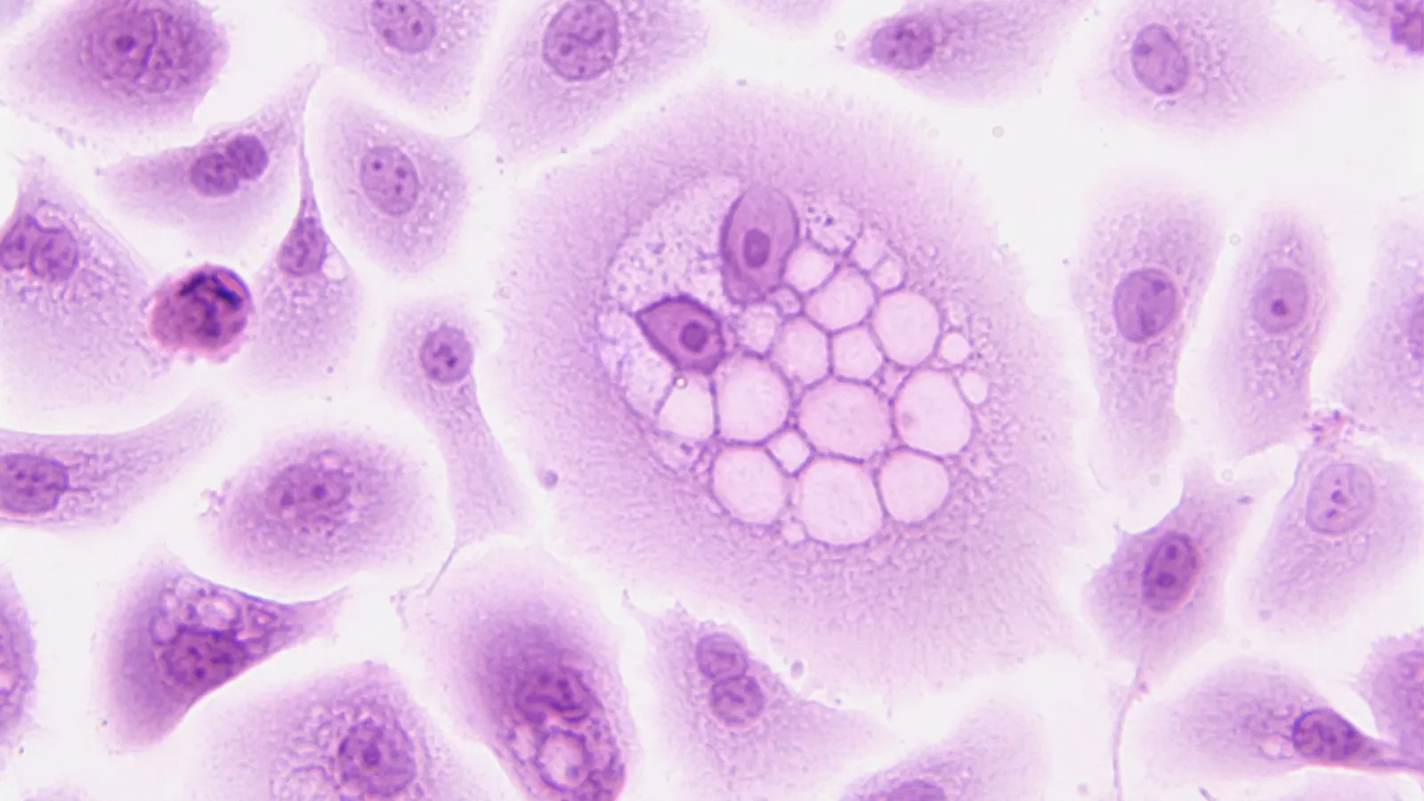 Stained cells under a microscope, one dividing cell in the centre