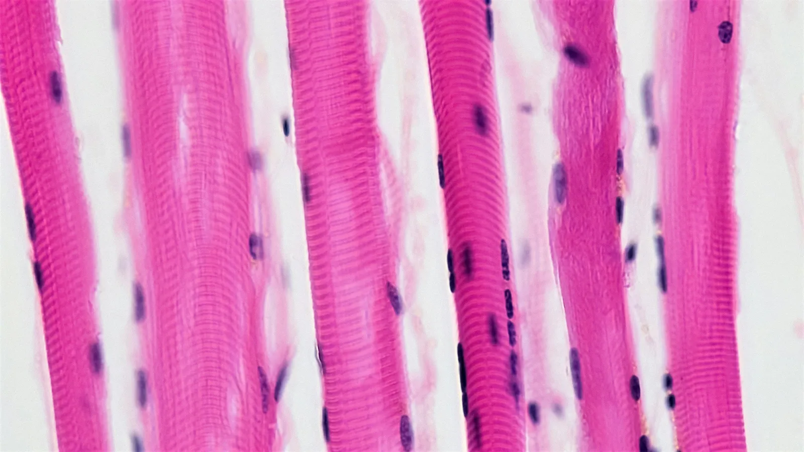 Stained muscle fibres with dark nuclei seen under a microscope