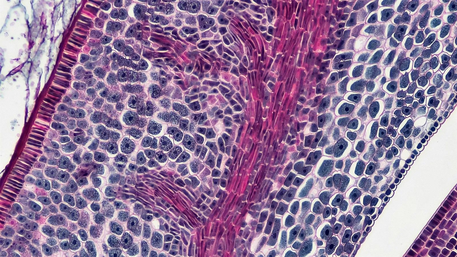 Stained plant cells seen under a microscope