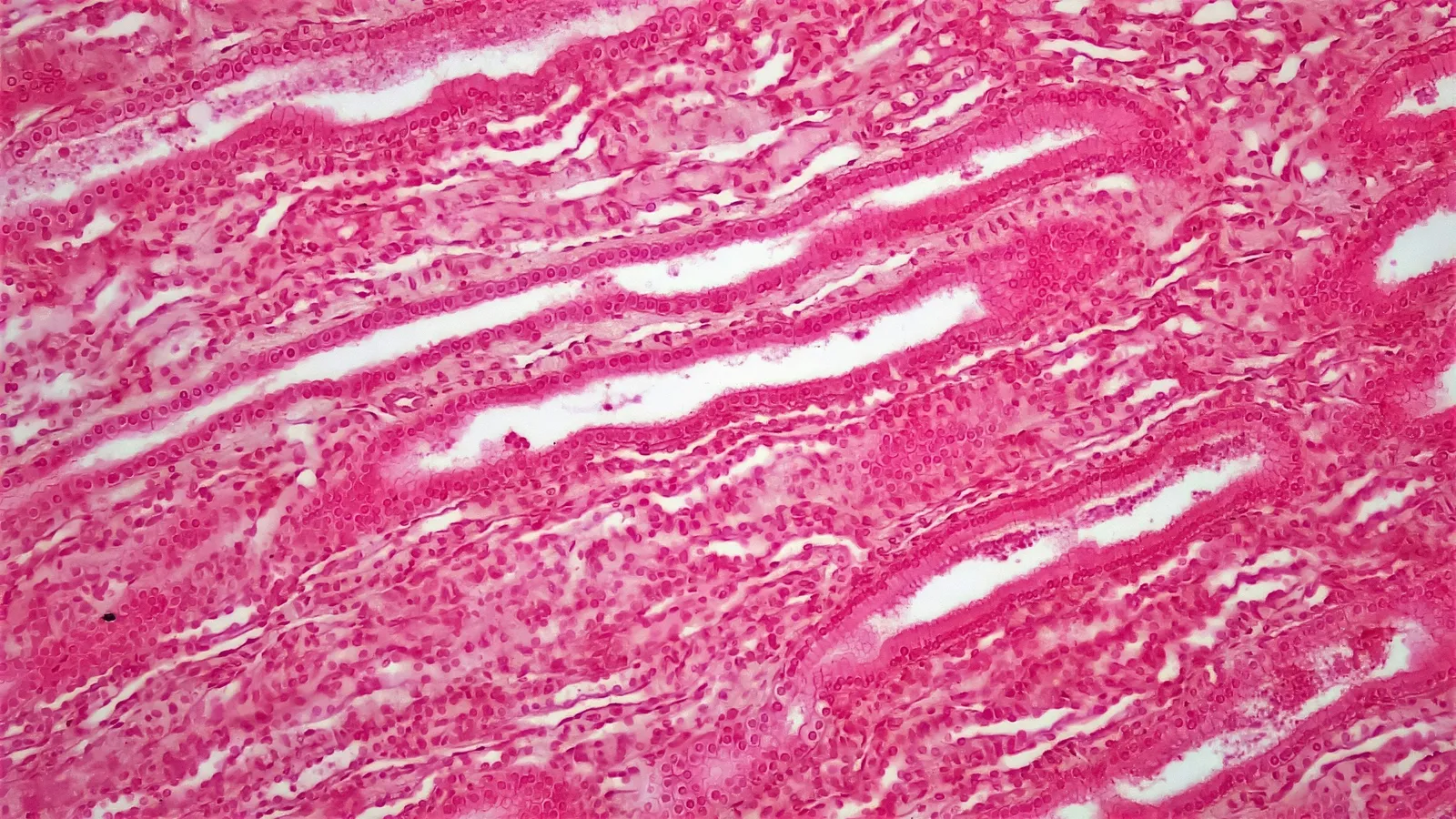 Stained tissue cells under a microscope