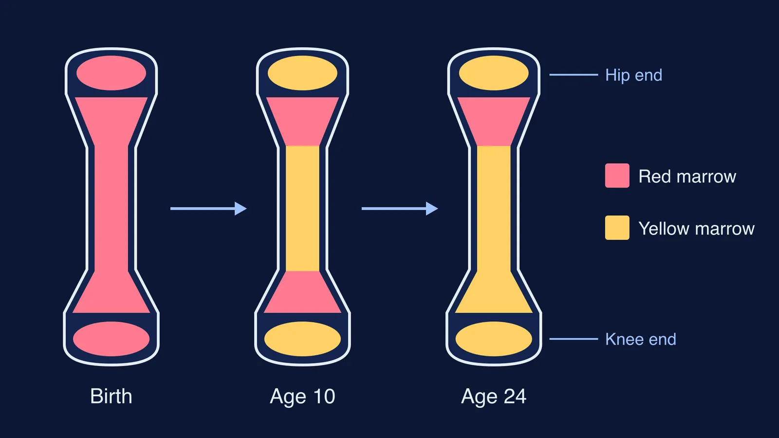 Three femurs showing red marrow turning yellow at birth, age 10 and 24