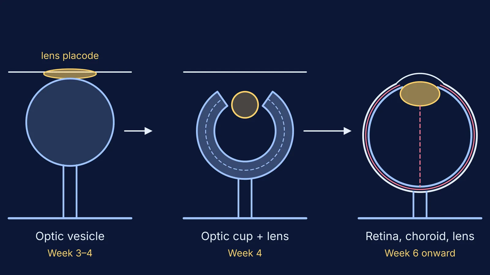 Three stages of eye formation: optic vesicle, optic cup with lens, formed eye