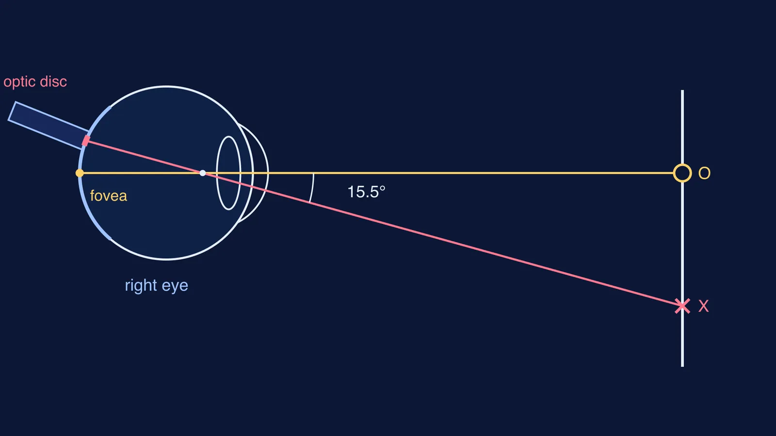 Top view of the right eye: a ray from the X lands on the optic disc