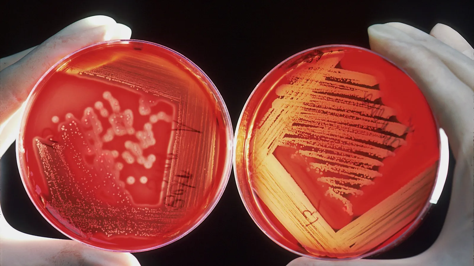 Two red culture plates of bacteria held in gloved hands