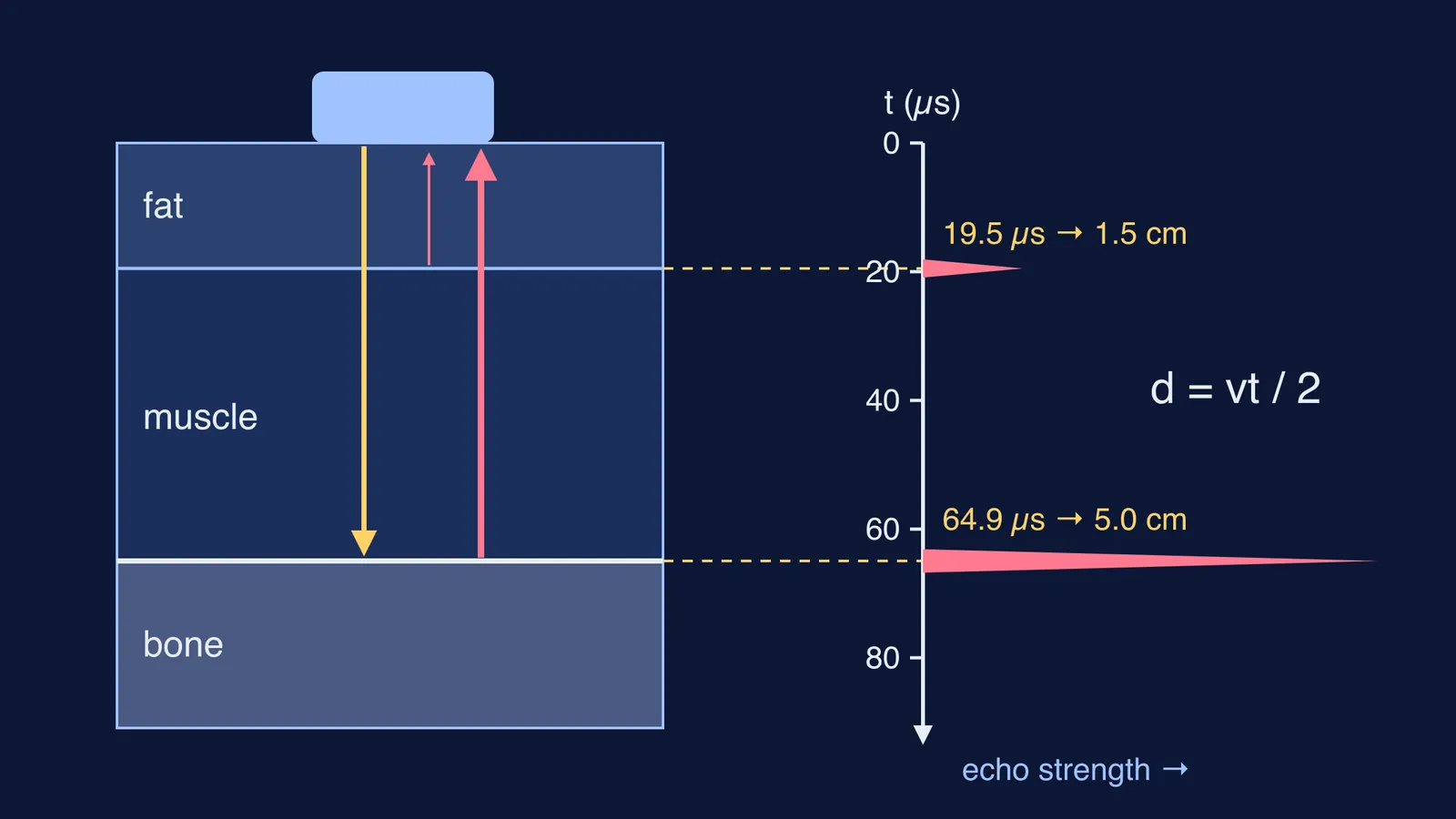 Ultrasound pulse entering fat, muscle and bone, with echo times marking each depth