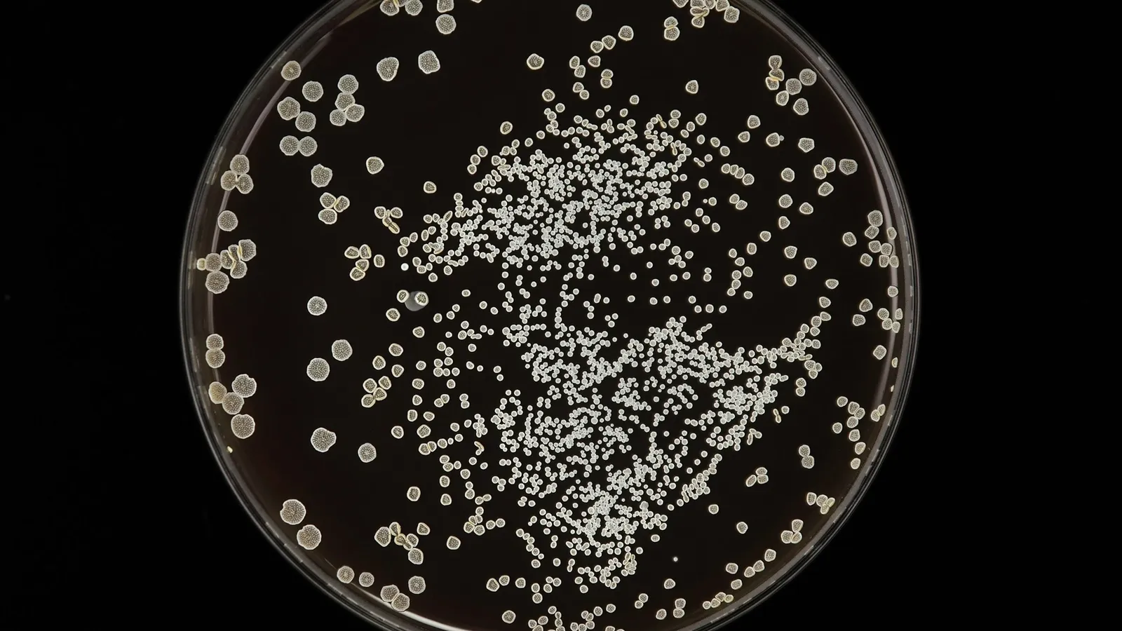 White bacterial colonies on a petri dish against black